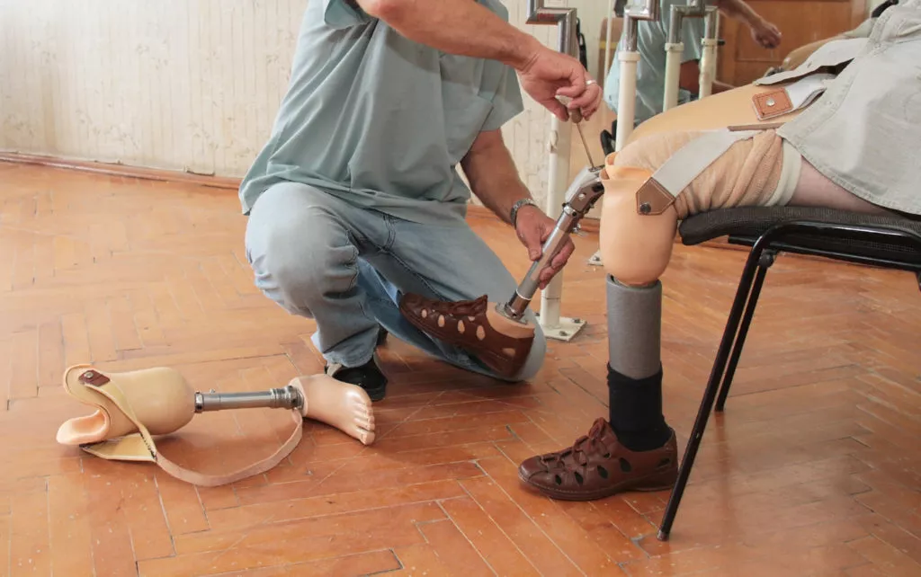 prosthetic devices for a catastrophic injury